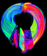 FORD PRO SERIES 10R80 TORQUE CONVERTER